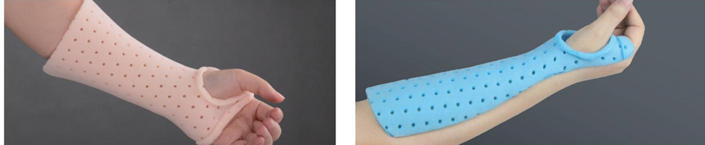 Thermoplastic for hand and wrist fixation.jpg