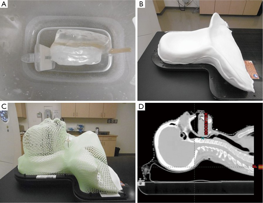 塑形垫在鼻咽癌质子治疗中的运用 | 摘自md安德森文章:proton therapy